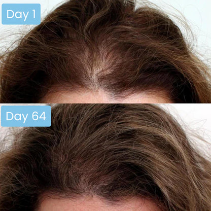 Scalpy Hair Ampoule