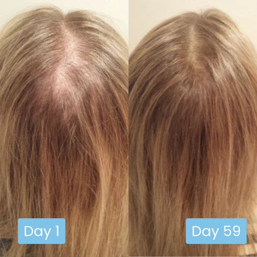 Scalpy Hair Ampoule