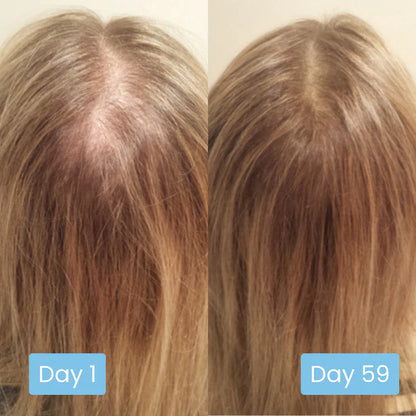 Scalpy Hair Ampoule