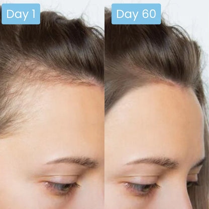 Scalpy Hair Ampoule